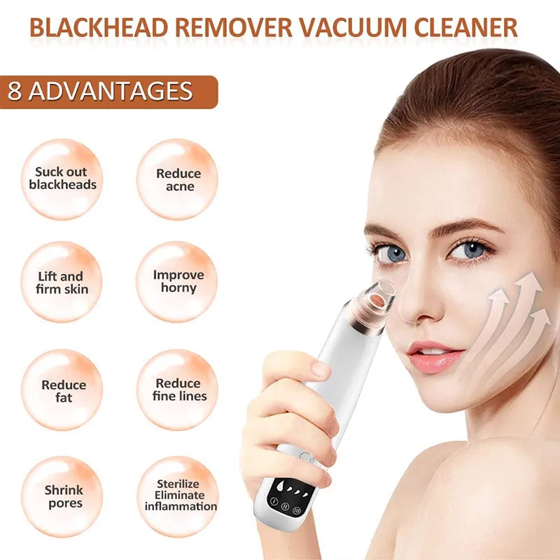 Blackhead Remover Vacuum for Facial Care - Pore Cleaner, Acne, and Pimple Removal Tool