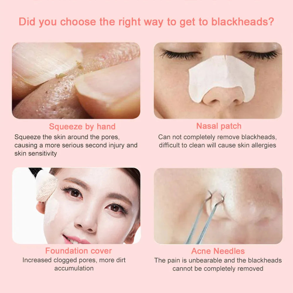Blackhead Remover Vacuum for Facial Care - Pore Cleaner, Acne, and Pimple Removal Tool
